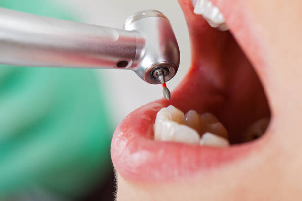 Best Emergency Denture Repair in Rocky River, OH